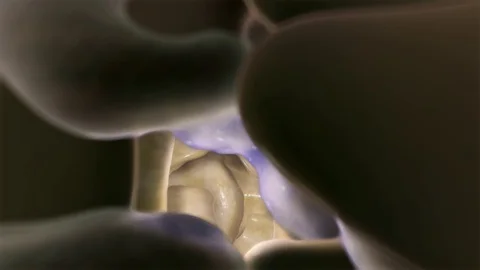 3d render of matrix skin cell degradation in eczema. http://www.polymime.com Stock Footage 75364429