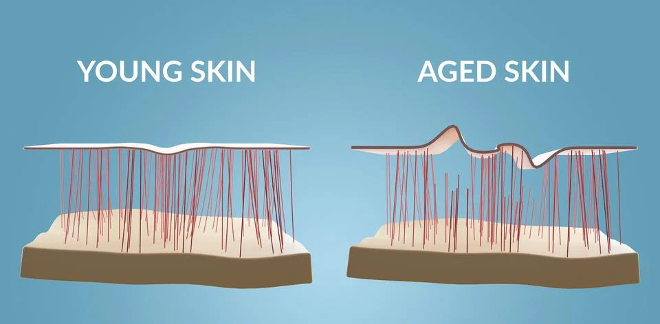 3d render of old and young skin, skin anatomy with collagen and wrinkles. Aging Stock Illustration