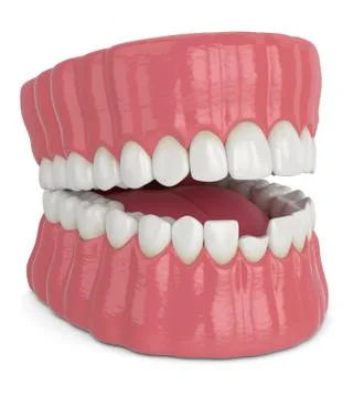 3d render of opened jaw with broken incisor lower tooth Stock Photos