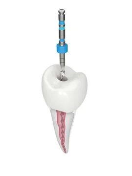 3d render of premolar tooth with endodontic rotary file over white background Stock Illustration