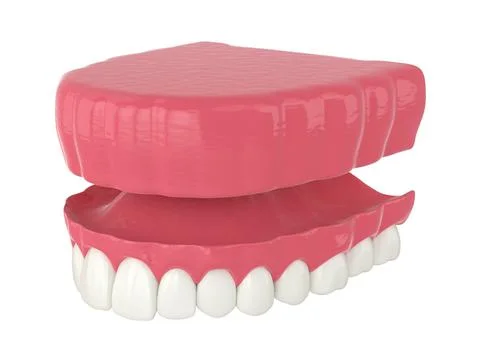 3d render of removable traditional denture installation Illustrazione stock