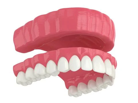 3d render of removable traditional denture installation Stock Illustration