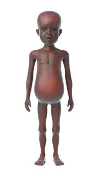 3d render of a starving African child Stockillustratie