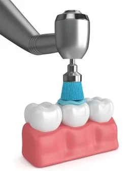 3d render of teeth with dental handpiece and polishing brush Illustrazione stock