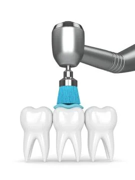 3d render of teeth with dental handpiece and polishing brush Illustrazione stock
