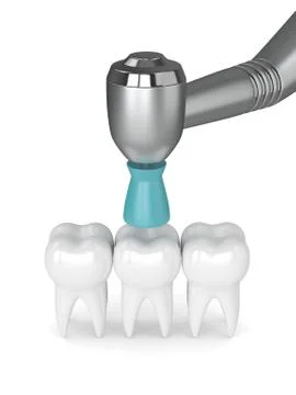 3d render of teeth with dental handpiece and polishing brush Stock Illustration