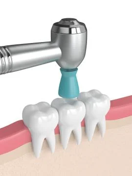 3d render of teeth with dental handpiece and polishing brush Stock Illustration