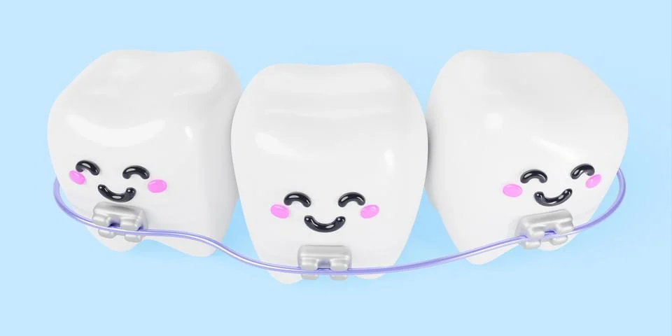 3d render teeth with metal braces, orthodontic brackets. Dental care, treatment Stock Illustration