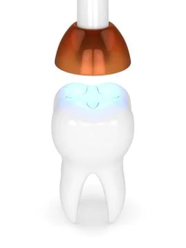 3d render of tooth with dental polymerization lamp and light cured inlay 스톡 사진