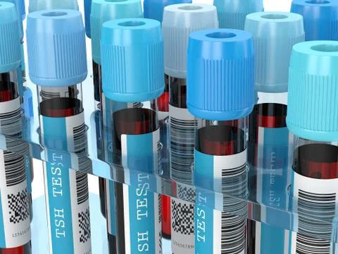 3d render of TSH test blood tubes in rack Illustrazione stock