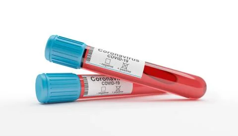 3d render of two blood collection tubes tested positive for coronavirus 스톡 일러스트
