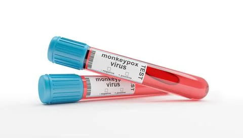 3d render of two blood collection tubes for monkeypox virus イラスト素材