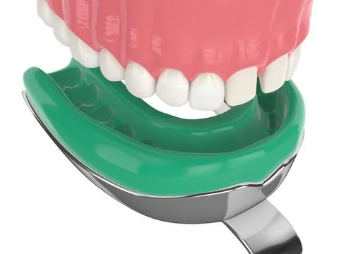 3d render of upper jaw with dental impression tray Stock Photos