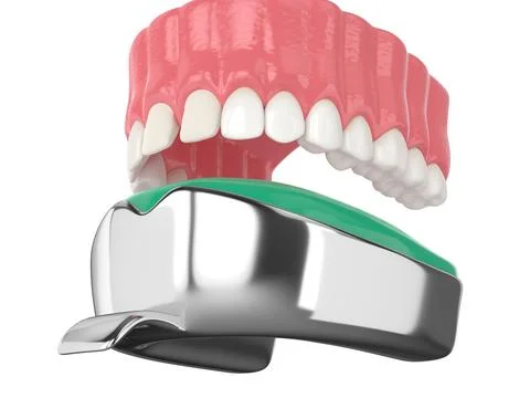 3d render of upper jaw with dental impression tray Stock Photos