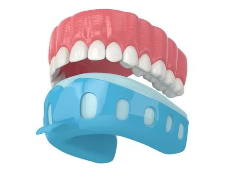 3d render of upper jaw with dental impression tray Stock Photos