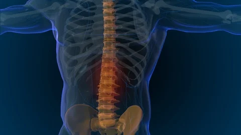 3d rendered illustration of back and spine pain 3D illustration Stock-Footage 113829674
