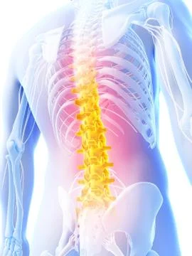 3d rendered illustration - backache Stock Illustration