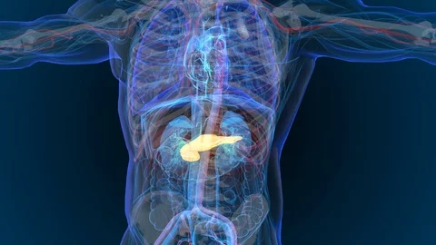 3d rendered illustration of pancreas - cancer - Illustration Stock Footage