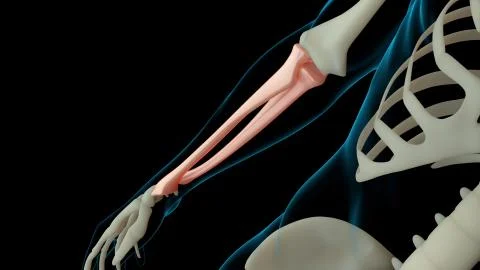 3d rendered illustration of skeleton structure with injured bones. Bone pain  Stock Illustration