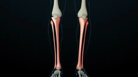 3d rendered illustration of skeleton structure with injured bones. Bone pain  Stock Illustration