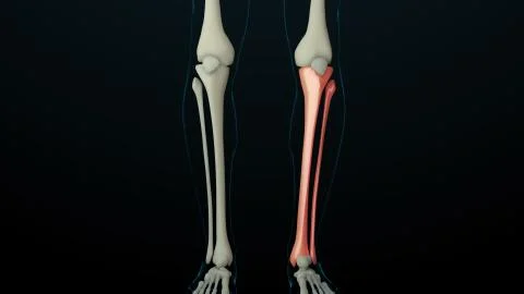 3d rendered illustration of skeleton structure with injured bones. Bone pain  Stock-Illustration