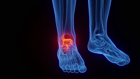 Medical Animation Foot Stock Footage ~ Royalty Free Stock Videos | Pond5