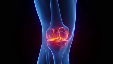 Medical Animation Knee Stock Footage ~ Royalty Free Stock Videos | Pond5 Medical Animation Knee Stock Footage ~ Royalty Free Stock Videos | Pond5