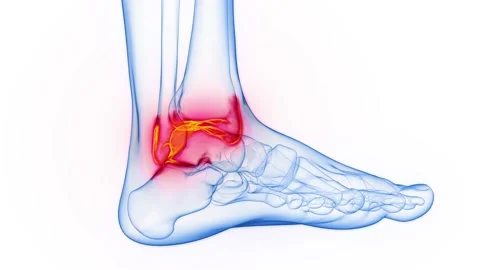 Medical Animation Foot Stock Footage ~ Royalty Free Stock Videos | Pond5