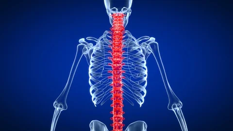 3d rendered medically accurate animation of a painful back Видео 119204116