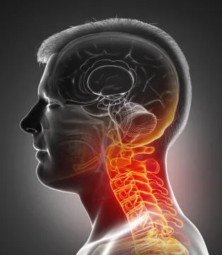 3d rendered, medically accurate illustration of male   having a painful neck. Stock Illustration