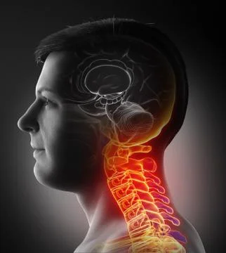 3d rendered, medically accurate illustration of male   having a painful neck. Stock Illustration