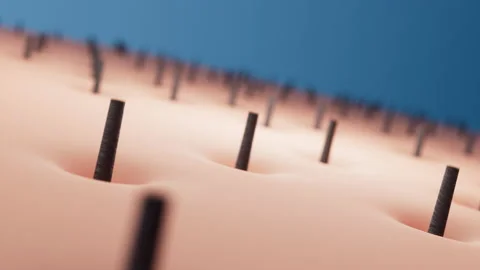 3d rendering, animation of hair removal ... | Stock Video | Pond5