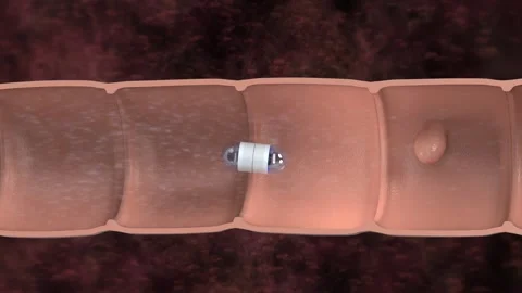 3d rendering capsule endoscopy in intestine cutaway 4k footage 스톡 동영상 309002284