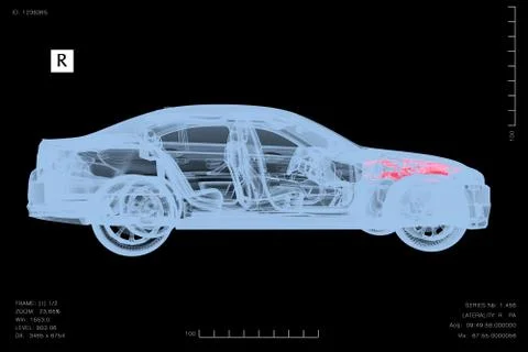 3D rendering of a conceptual image of a car under diagnosis with x-rays Stock Illustration