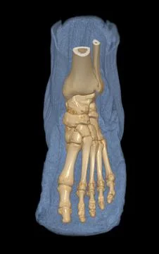 3D rendering  of the foot bones for diagnosis bone fracture and rheumatoid ar Illustrazione stock