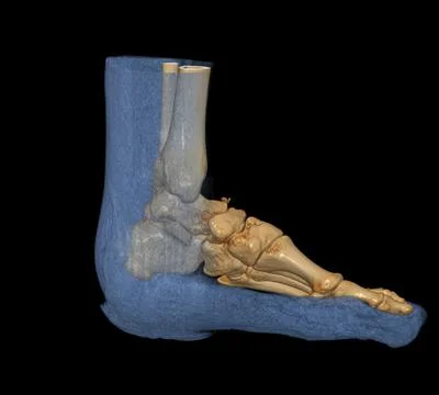 3D rendering  of the foot bones for diagnosis bone fracture and rheumatoid ar Illustrazione stock