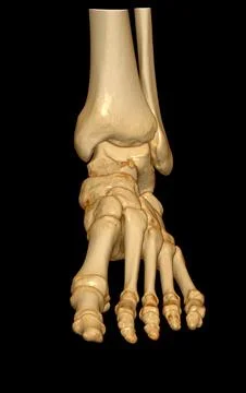 3D rendering  of the foot bones for diagnosis bone fracture and rheumatoid ar Stock-Illustration