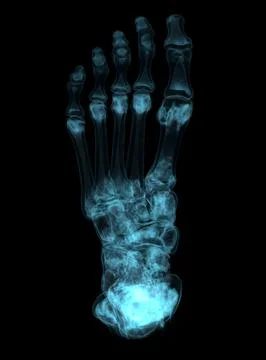 3D rendering  of the foot bones for diagnosis bone fracture and rheumatoid ar Stock Illustration