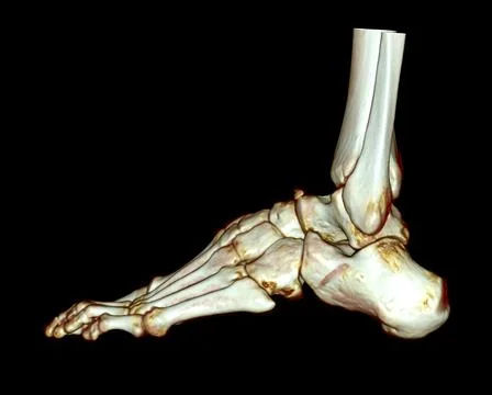 3D rendering  of the foot bones for diagnosis bone fracture and rheumatoid ar Stock-Illustration
