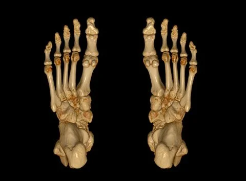 3D rendering  of the foot bones for diagnosis bone fracture and rheumatoid ar Illustrazione stock