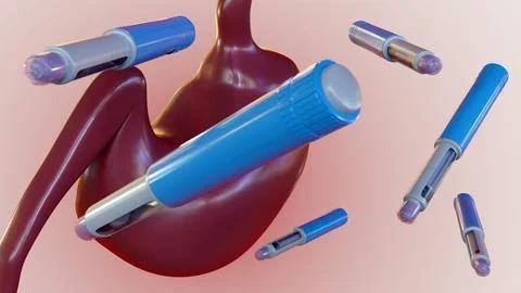A 3D rendering of GLP-1 or insulin pens positioned over a stomach diagram. Stock Illustration