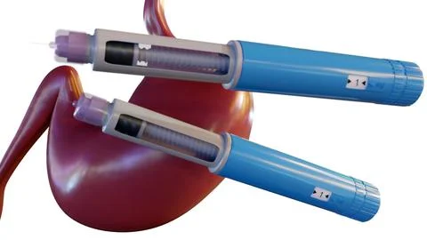 A 3D rendering of GLP-1 or insulin pens positioned over a stomach diagram. Stock Illustration
