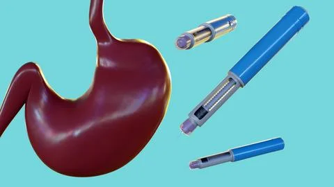 A 3D rendering of GLP-1 or insulin pens positioned over a stomach diagram. Stock Illustration