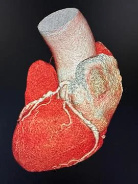 3D rendering of the human heart Foto stock