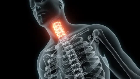 3D Rendering of a Medical Animation of the Cervical Vertebrae. X-ray of the Stock Footage 233345044