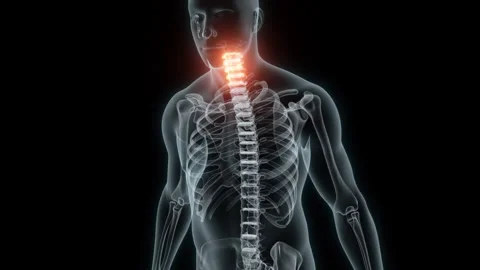 3D Rendering of a Medical Animation of the Cervical Vertebrae. X-ray of the Stock Footage 233346166