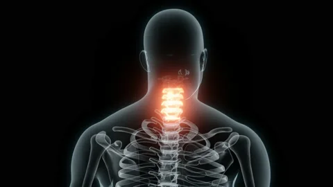 3D Rendering of a Medical Animation of the Cervical Vertebrae. X-ray of the Stock Footage 233347265