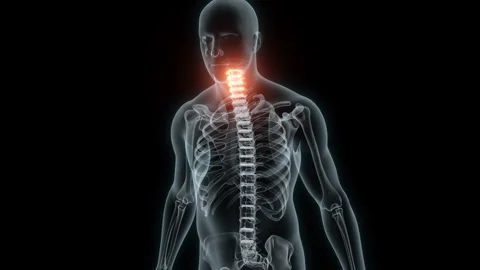 3D Rendering of a Medical Animation of the Cervical Vertebrae. X-ray of the Stock Footage 233347677