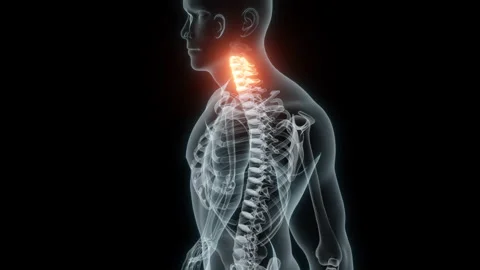 3D Rendering of a Medical Animation of the Cervical Vertebrae. X-ray of the Stock Footage 233348360