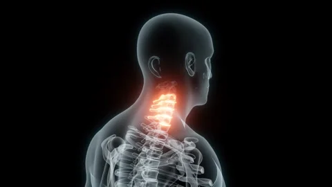 3D Rendering of a Medical Animation of the Cervical Vertebrae. X-ray of the Stock Footage 233350610